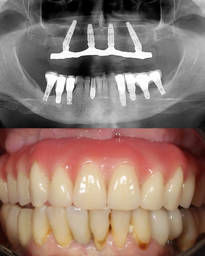 resultados cristian manenti 02