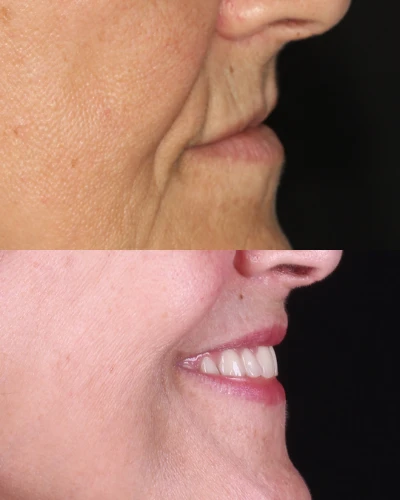 resultados cristian manenti 03