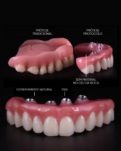 resultados cristian manenti 05