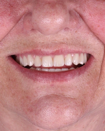 resultados cristian manenti 10