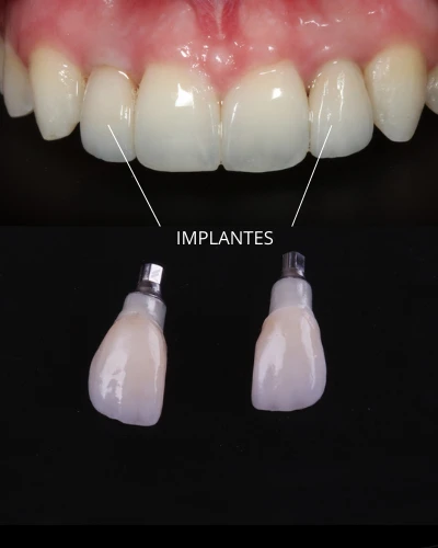 resultados cristian manenti 12