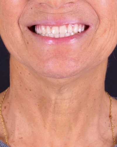 resultados cristian manenti 18